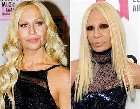 donatella versace antes y ahora|La transformación de Donatella Versace: Antes y después en la .